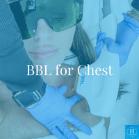 BBL Photorejuvenation for the Chest Black Friday Sale