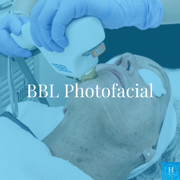 BBL Photo Facial Black Friday Sale