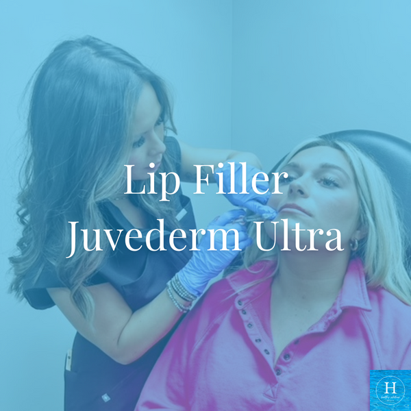 Lip Filler Treatment - Juvederm Ultra 1ml Black Friday Sale