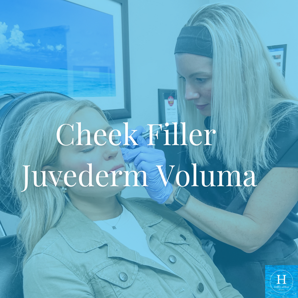 Cheek Filler with Juvederm Voluma Black Friday Sale